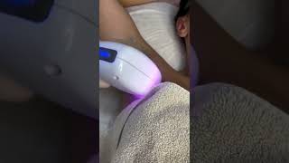 Laser Hair Removal skincare londonaestheticsrejuvenation [upl. by Hairakcaz156]