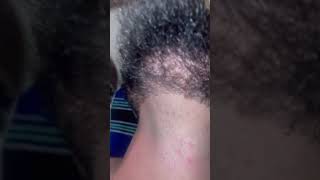 Asmr plucking out ingrown hairs from beards barbershop barber hair shaver ukbarber barberhood [upl. by Nithsa]