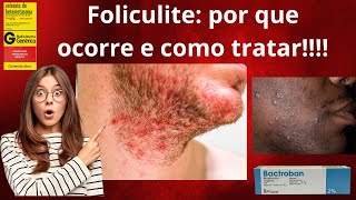 Foliculite por que ocorre e como tratar [upl. by Stefanac]