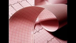 Electrocardiogram Characteristics of the ECG paper Standarization Papel de ECG Estandarización [upl. by Llemaj]