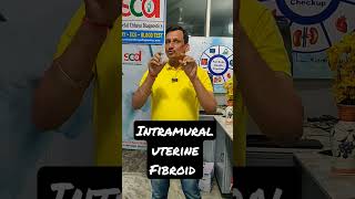 What Are Intramural Fibroids ajaykaushik sheetalchhaya lab bestdignosticcentre health [upl. by Garges917]