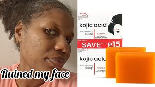 I tried this trending Kojic San soap and this happened [upl. by Ches853]