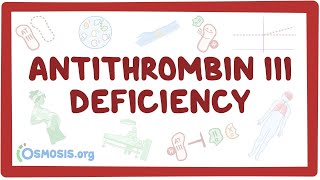 Antithrombin Deficiency Symptoms and Causes  Diagnosis  Treatment  Prevention [upl. by Lorry]