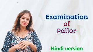 Examination of Pallor In Hindi [upl. by Nepil143]