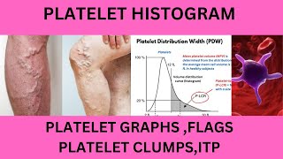 PLATELET HISTOGRAMPLATELET GRAPHPLATELET INDICESPLATELET FLAGSPLTPLT LCRPLTMP FLAGPUPL FLAG [upl. by Anelrac]