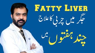 Fatty liver treatment in weeks by Dr Ikram [upl. by Acie65]