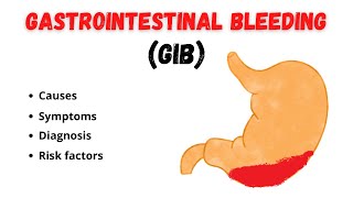 GI Bleeding  Causes Symptoms Diagnosis and risk factors based on 2022 references [upl. by Sabanrab]