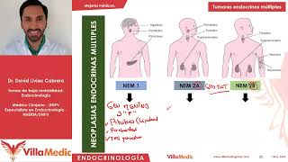 Tumores endocrinos múltiples  Endocrinologia [upl. by Norod]