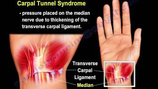 wrist paincauses and treatment PART I Everything You Need To Know  Dr Nabil Ebraheim [upl. by Nyroc121]