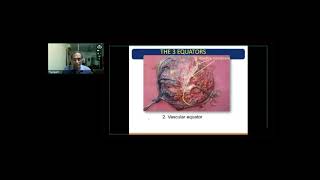 GE Webinar on Monochorionic Twins by Dr S Suresh [upl. by Erdeid77]