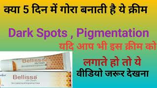 Bellissa lite Cream क्या चेहरे को बिना किसी Side effects के गोरा बनाती है [upl. by Aierbma152]