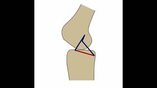 Flexion and extension of the knee according to four bar linkage fixed links [upl. by Ecarg]