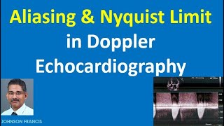 Aliasing and Nyquist Limit in Doppler Echocardiography [upl. by Selry]