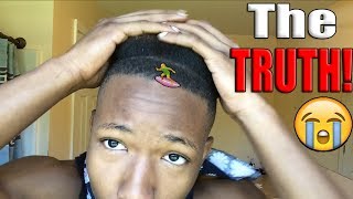 THE TRUTH ABOUT MY HAIRLINE  FRONT TAPER 😢 [upl. by Atteirneh]