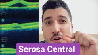 Me recuperei da Serosa Central [upl. by Kcirevam]