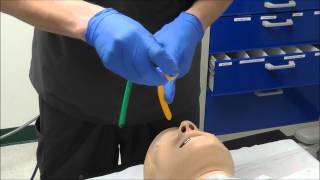 Nasal Intubation [upl. by Pascoe]