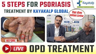 Step by Step Psoriasis Treatment by Kayakalp Global  Palmoplantar Psoriasis को कैसे ठीक करें [upl. by Whipple]