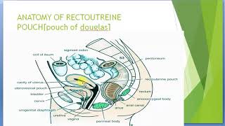 Culdocentsis and Anatomy of Rectoutrine pouch  MEDICAL FACT [upl. by Indnahc]