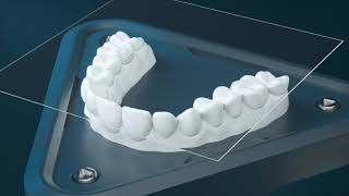 The Next Generation in Clear Aligners  Reveal® [upl. by Yttam]