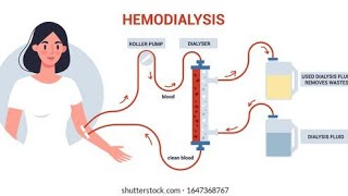 Dialysis and its type by Lecturer Rizwana Naseem [upl. by Islek]