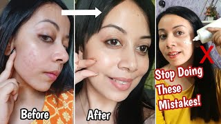 You Are Doing These Skincare Mistakes Now  How to Repair Damaged Skin Barrier At Home [upl. by Ileane]