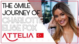 THE SMILE JOURNEY OF THE EXTREMELY BEAUTIFUL amp CHARMING INFLUENCER CHARLOTTE ELISE FOX atteliadent [upl. by Anselmo345]