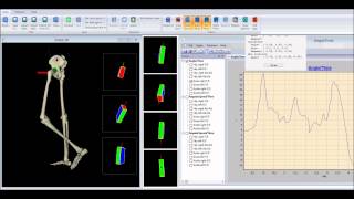 Gait analysis with bluetooth inertial sensors [upl. by Onaicnop123]