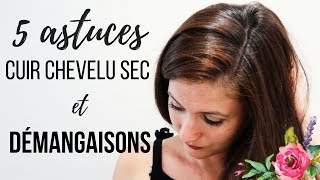 ⚠CUIR CHEVELU SEC démangeaisons et pellicules  5 conseils soins [upl. by Ramas]