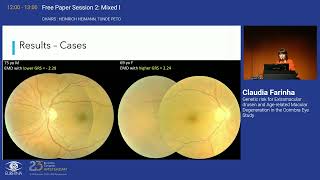 2 Genetic risk for Extramacular drusen and Agerelated Macular Degeneration in the Coimbra Eye Stud [upl. by Dollar]