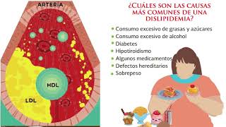 Dislipidemias MIC [upl. by Icnarf680]