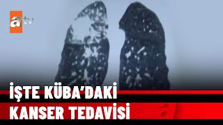 ÖZEL HABER –KÜBA ÖZEL DOSYASI  Kübadaki kanser tedavisinin tüm detayları  27 Aralık 2021 [upl. by Tychonn]