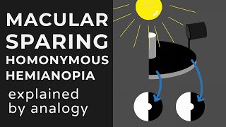 Macular Sparing amp Splitting Homonymous Hemianopia  Animation  Explained Conceptually [upl. by Adnwahsat]