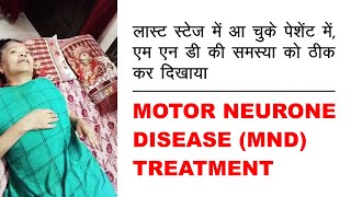 Motor Neuron Disease MND Treatment  Treatment given by Dr Ashish Gilhotra [upl. by Akihsan]