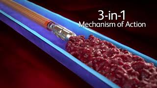 Aspirex™ Thrombectomy System 3in1 Mechanism of Action [upl. by Oster]