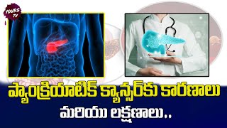 Signs and Symptoms of Pancreatic Cancer  ప్యాంక్రియాటిక్ క్యాన్సర్ లక్షణాలు amp కారణాలు  yourstv [upl. by Lindemann]