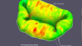 Mitral Valve Simulation [upl. by Ahsinan673]