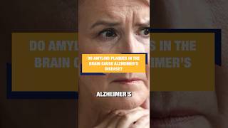 Do Amyloid Plaques in the Brain Cause Alzheimer’s Disease [upl. by Sacrod]