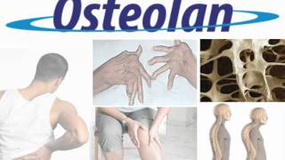 Osteolan [upl. by Adnole20]