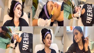 Melasma treatment by Homeopathic in Delhi  Dr Batra’s clinic  Pigmentation 🧏‍♀️ 😫 [upl. by Anila]