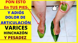 PON ESTO EN TU PIES  Eliminar Varices Dolor de Articulaciones Pies y Rodilla Beneficios del Nopal [upl. by Rasla]