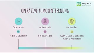 Diese Behandlungsmöglichkeiten gibt es bei Akromegalie  Akren vergrößert Therapie [upl. by Enelehs]