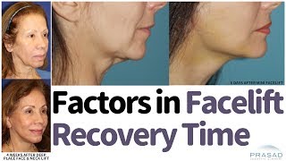 How Facelift Recovery can be Faster Without Compromising Results or Longevity [upl. by Jere229]