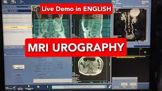 MRI Urography  English Subtitles [upl. by Donaugh]