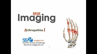 7Polyarthropathy imaging I Prof Mamdouh Mahfouz [upl. by Hgielah503]
