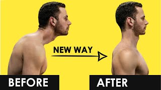 Fix Hunchback Posture in 4 Steps  Science Based Recommendations [upl. by Notslar]