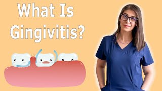 What Is Gingivitis  How To Treat Gingivitis [upl. by Sabelle536]