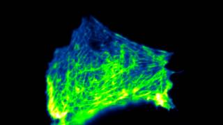 Effect of Latrunculin A on actin [upl. by Alimak]