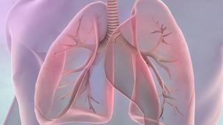 Symptoms of lung cancer [upl. by Assil]