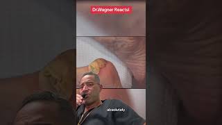 INCISION amp DRAINAGE OF HUGE HEEL ABSCESS🤯shorts [upl. by Wootten342]