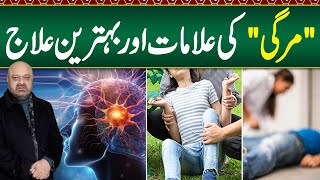 Mirgi Symptoms amp Treatment  Mirgi Ka Dora  Epilepsy Attack Treatment amp Types of Epilepsy [upl. by Nicolas663]